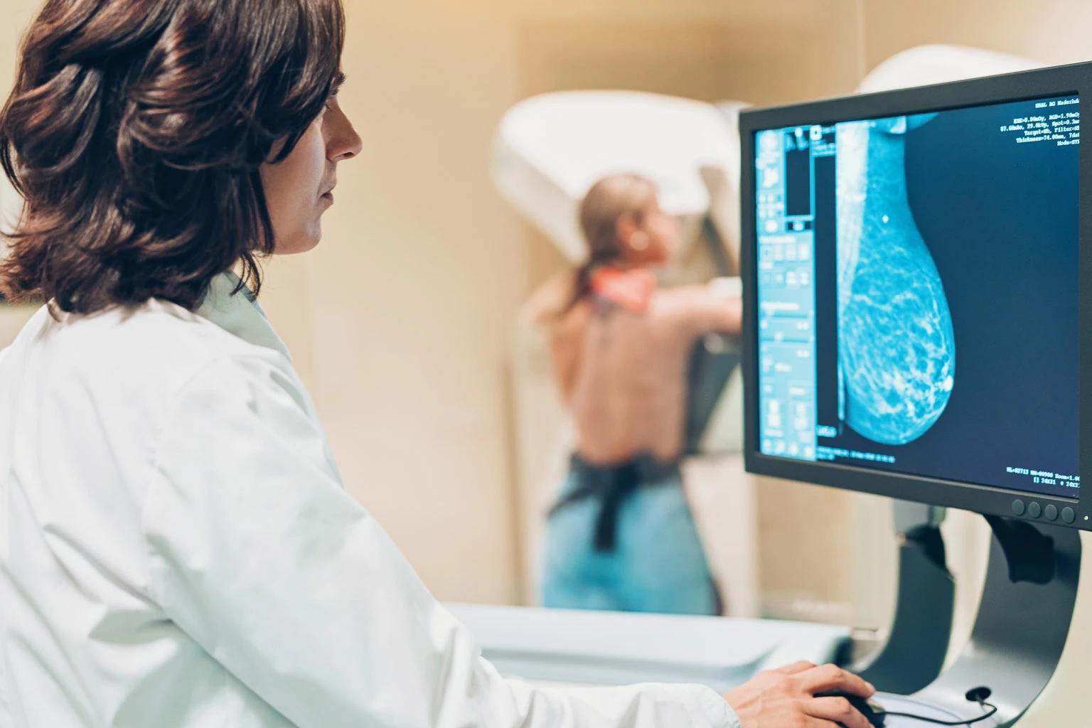La inteligencia artificial en la detección del cáncer de mama